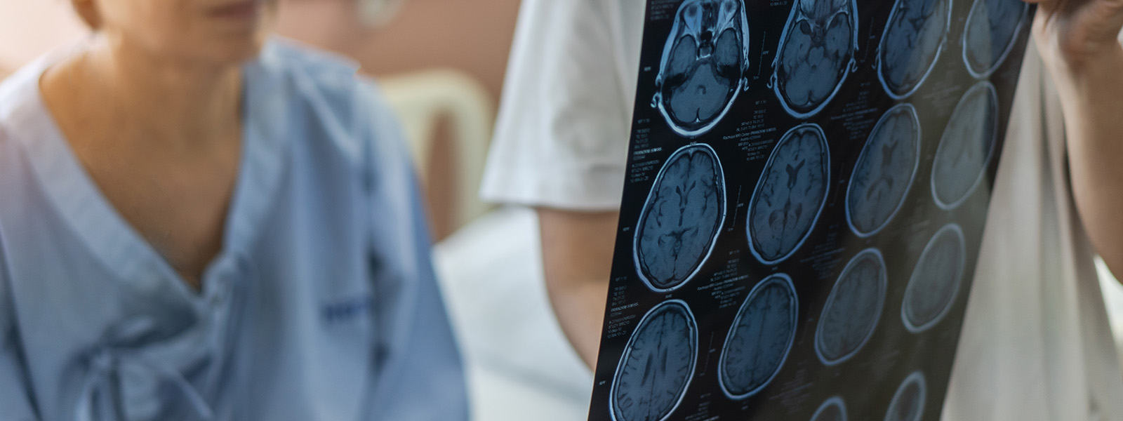 How To Choose the Right Traumatic Brain Injury Attorney